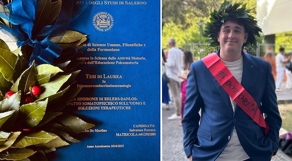 Maiori festeggia Salvatore Ferrara: laurea all'Università di Salerno e una tesi sulla sindrome di Ehlers-Danlos